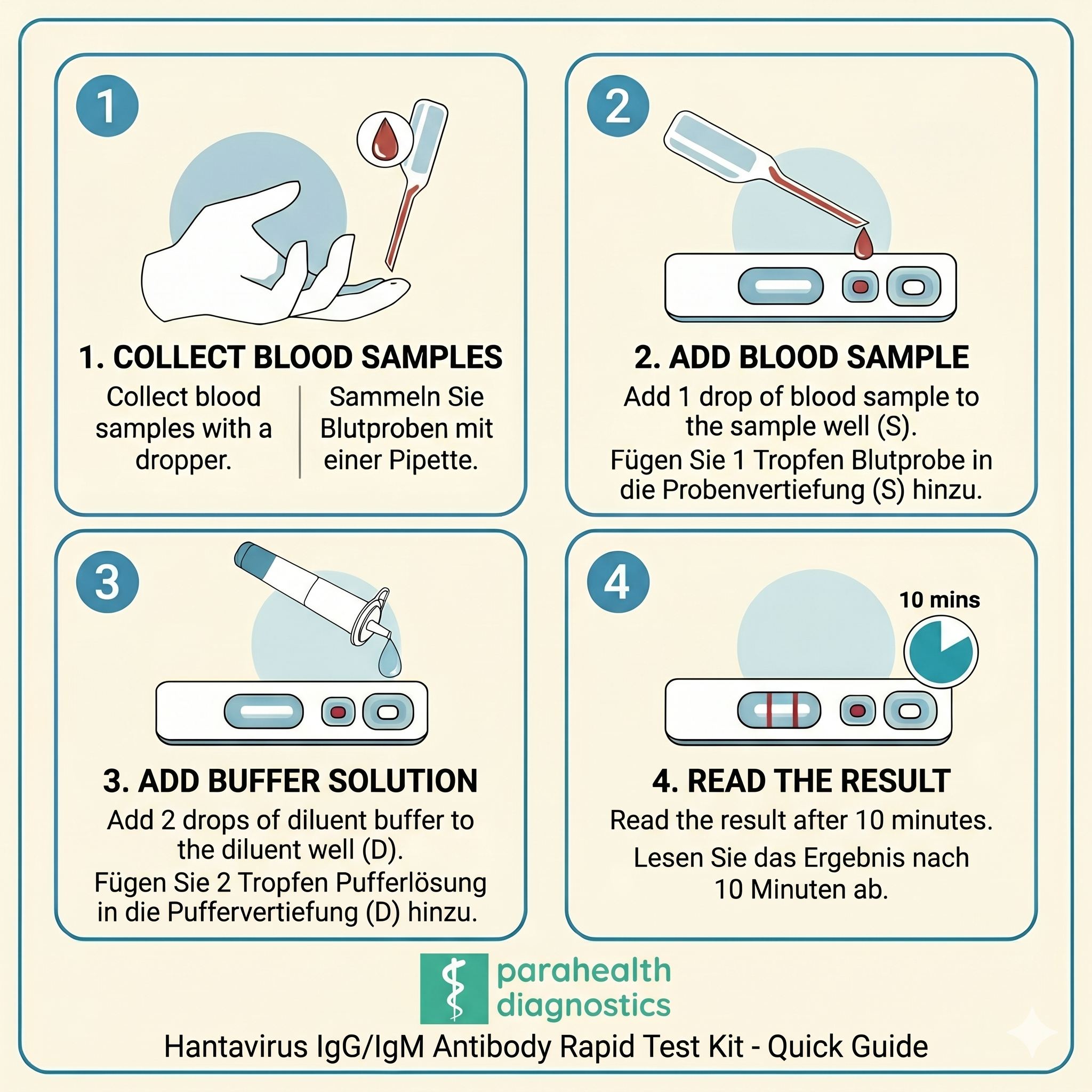 Hantavirus IgG/IgM Antibody Rapid Test Kit